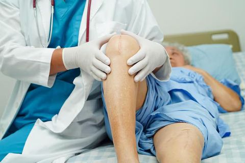 Knee Replacement Guide: Types, Procedure, Recovery, Risks, Benefits, and Patient Care