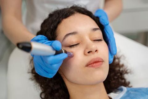 Laser Resurfacing for Eye Bags Explained: Treatment Techniques, Skin Rejuvenation and Aesthetic Applications