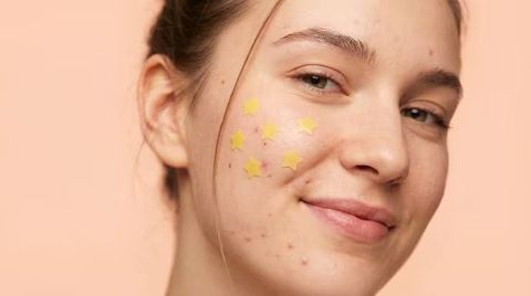 Pimple Patches Advice: Usage Methods, Skin Preparation, Application Timing, Removal and Irritation Prevention