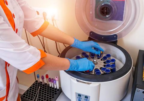 Ultra High UV Curing Systems Guide to Advanced Curing Technology