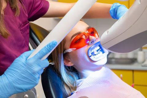 Teeth Whitening Discover Professional Methods for Brighter Smiles